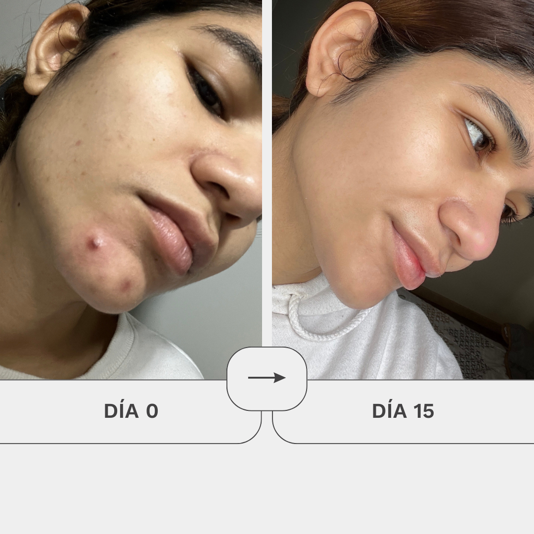 Crema Gel De Regeneración