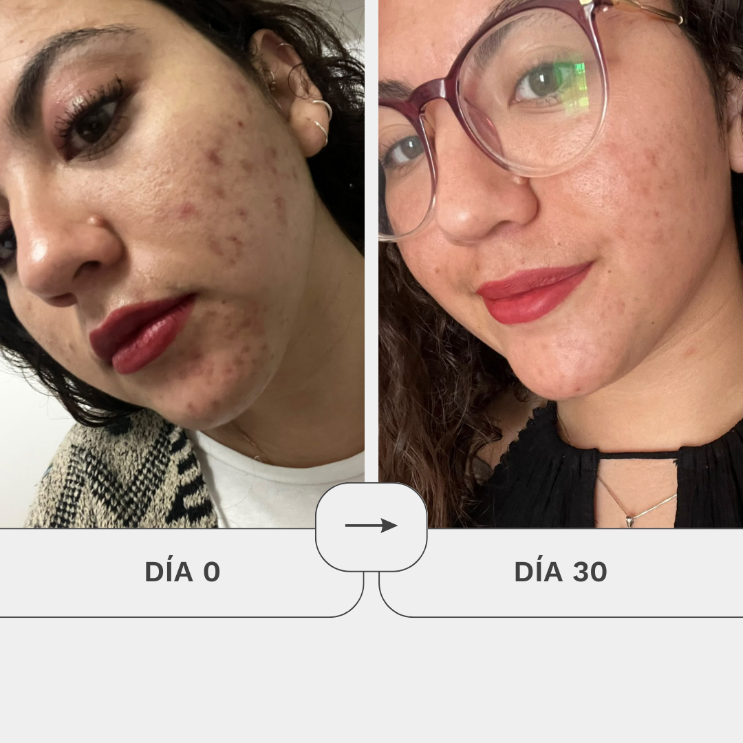Crema Gel De Regeneración