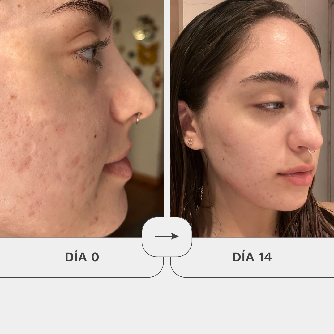 Crema Gel De Regeneración