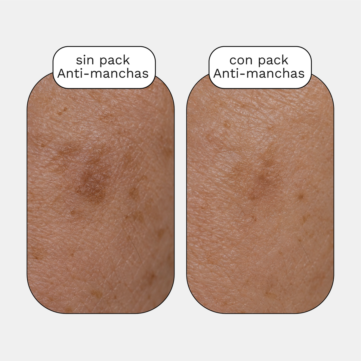 PACK ANTI-MANCHAS